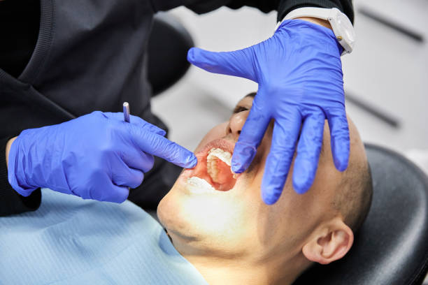 Best Broken Tooth Emergency  in Rock Creek, MN